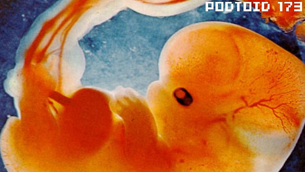 Podtoid 173: Fetus Dreams