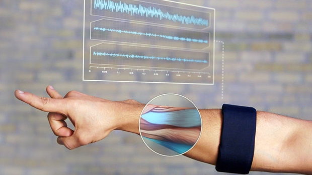 Play videogames with a gesture control armband