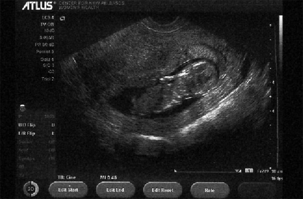 So it looks like Atlus is pregnant...