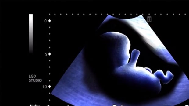 i Live is a creepy baby simulator for iOS