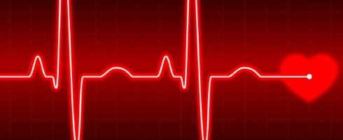 June NPD: Fourth consecutive month of year-over-year declines