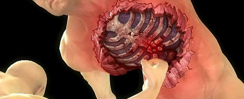 Mortal Kombat's bone breaking X-Ray gameplay detailed