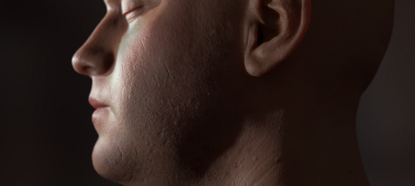 MANFACE: Perfecting CG Spotty Skin
